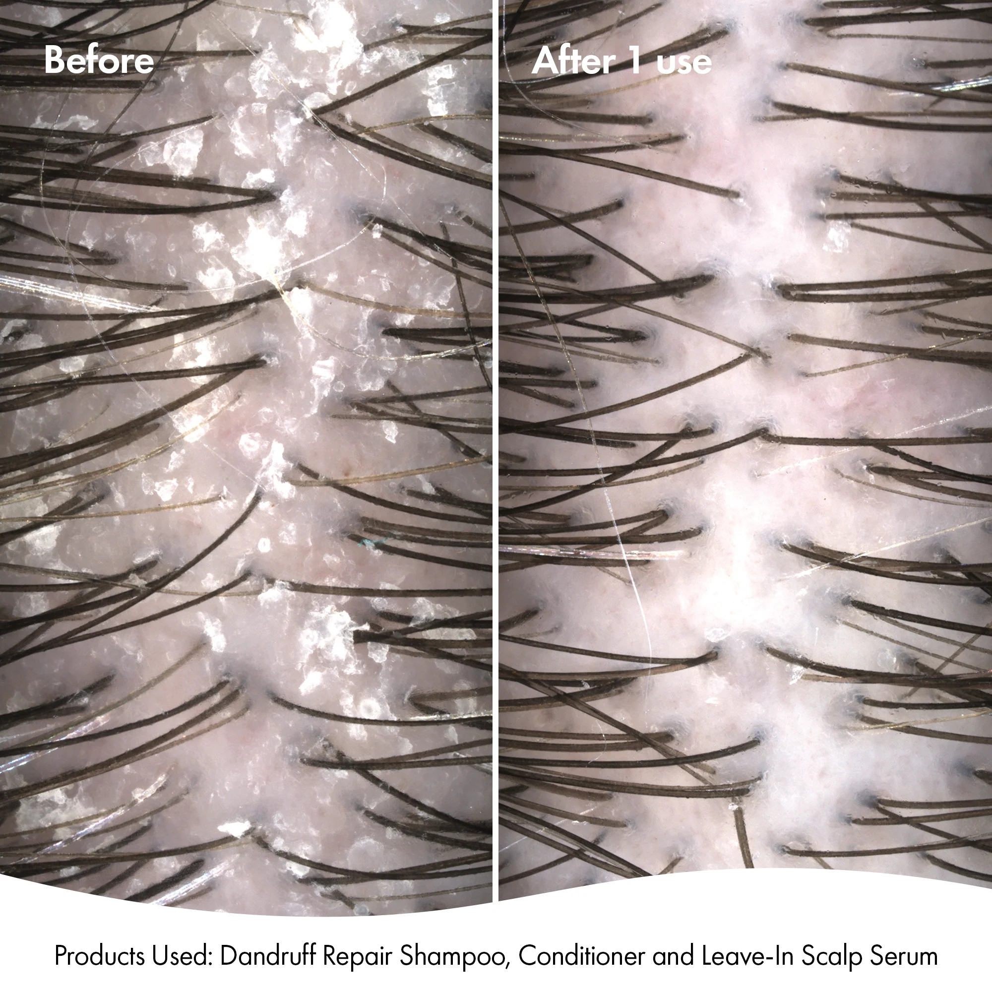 DANDRUFF CONDITIONER - Image 3