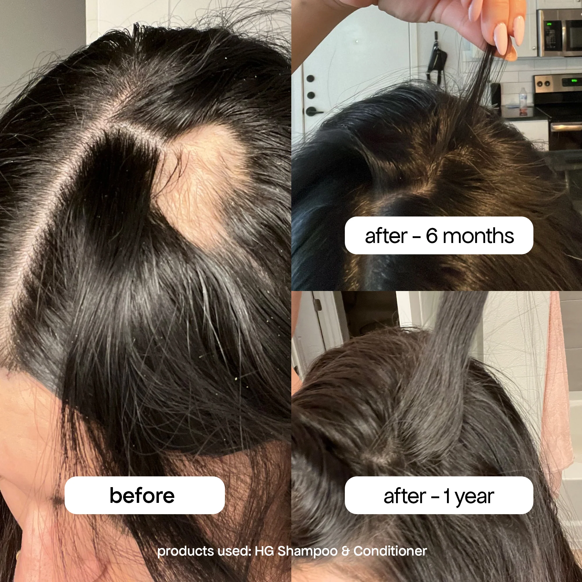 ANTI-THINNING SHAMPOO - Image 9