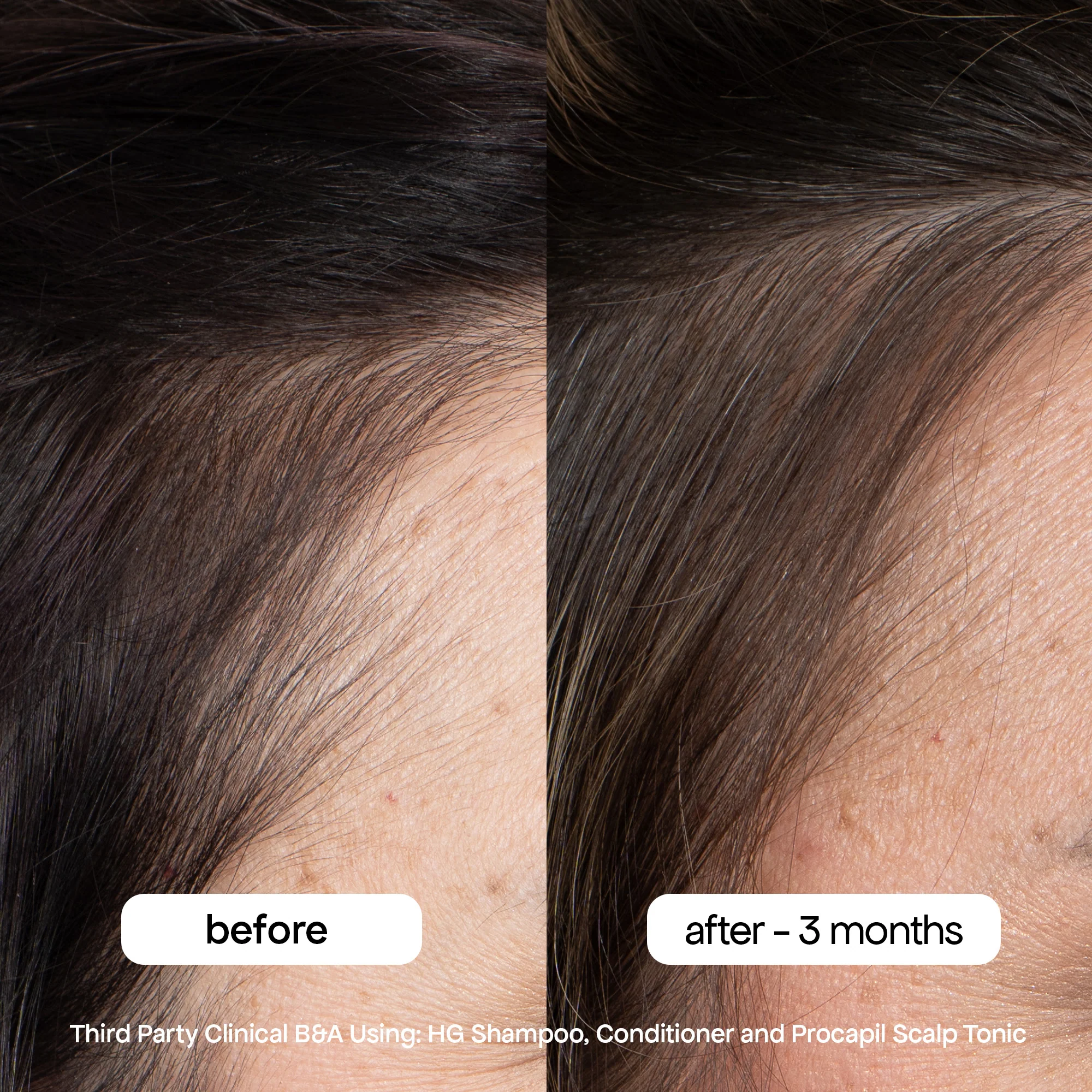 ANTI-THINNING CONDITIONER - Image 6