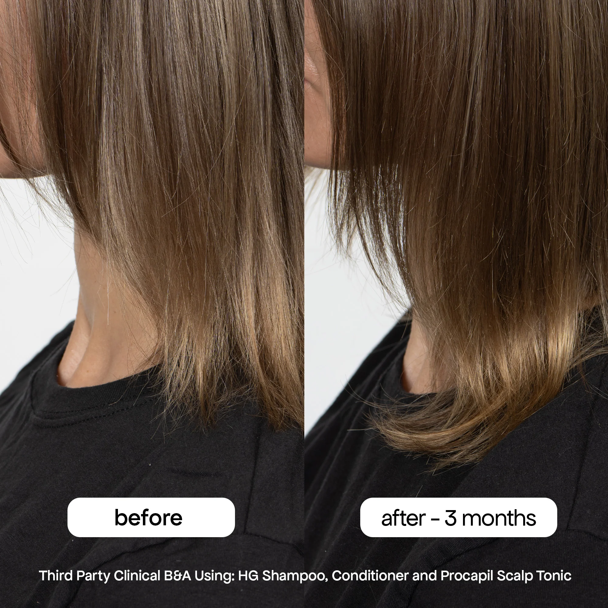 ANTI-THINNING SHAMPOO & CONDITIONER DUO - Image 7