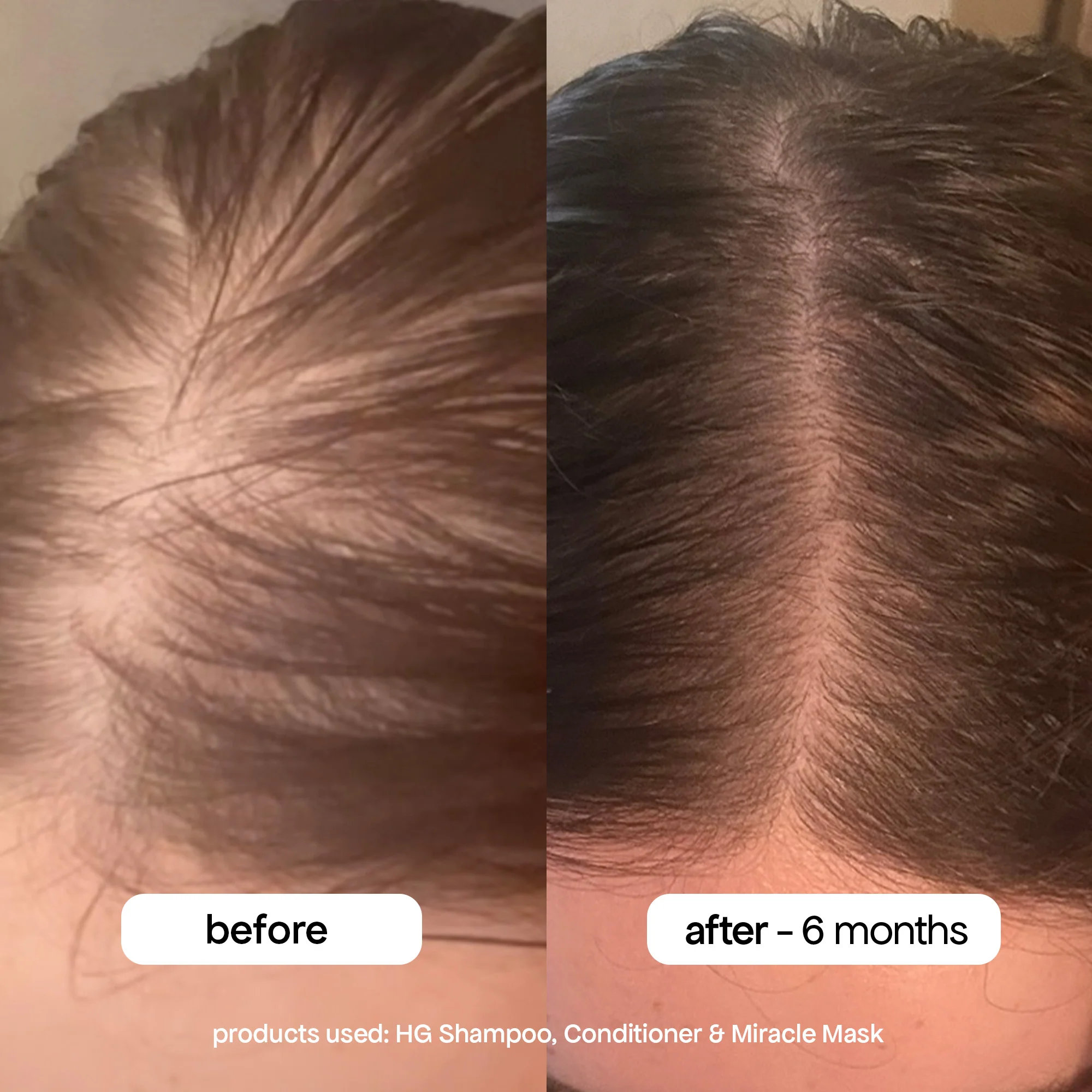 MIRACLE HAIR MASK - Image 5